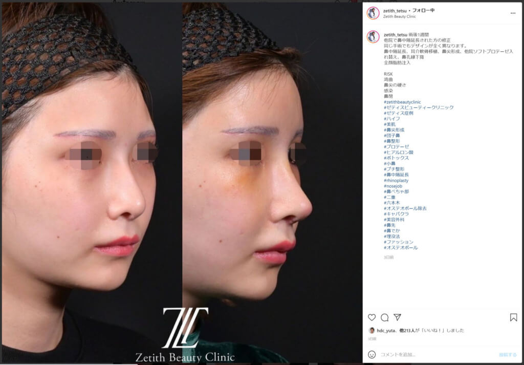 15位　鉄 鑠　医師　美容外科皮膚科　画像　Instagram　プロフィール　インスタ　先生　二重　鼻