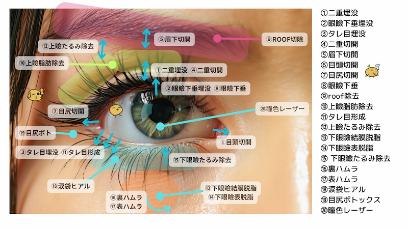 目元整形の種類まとめ